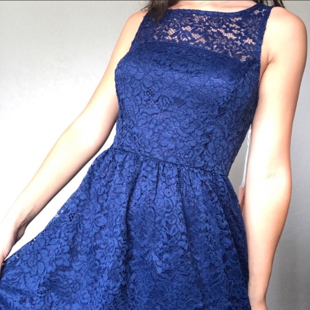 Forever21 Blue Lace Dress